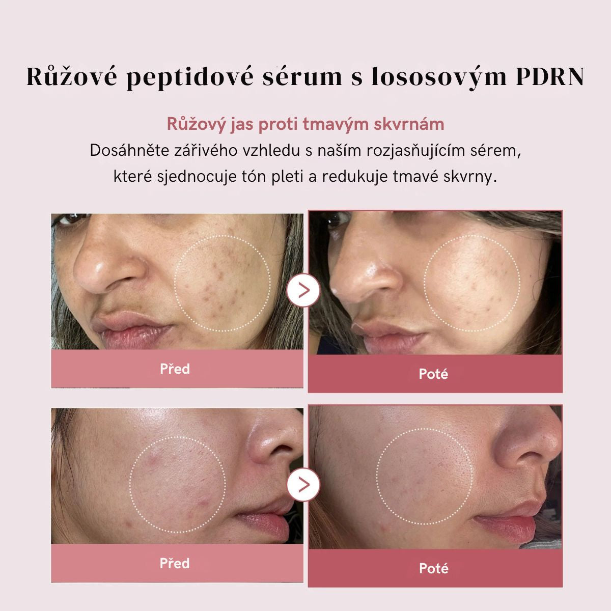 PDRN Pink Serum Peptide – Hloubková hydratace, efekt "Glass Skin"