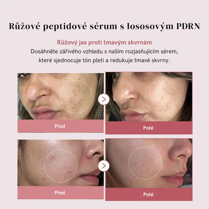 PDRN Pink Serum Peptide – Hloubková hydratace, efekt "Glass Skin"